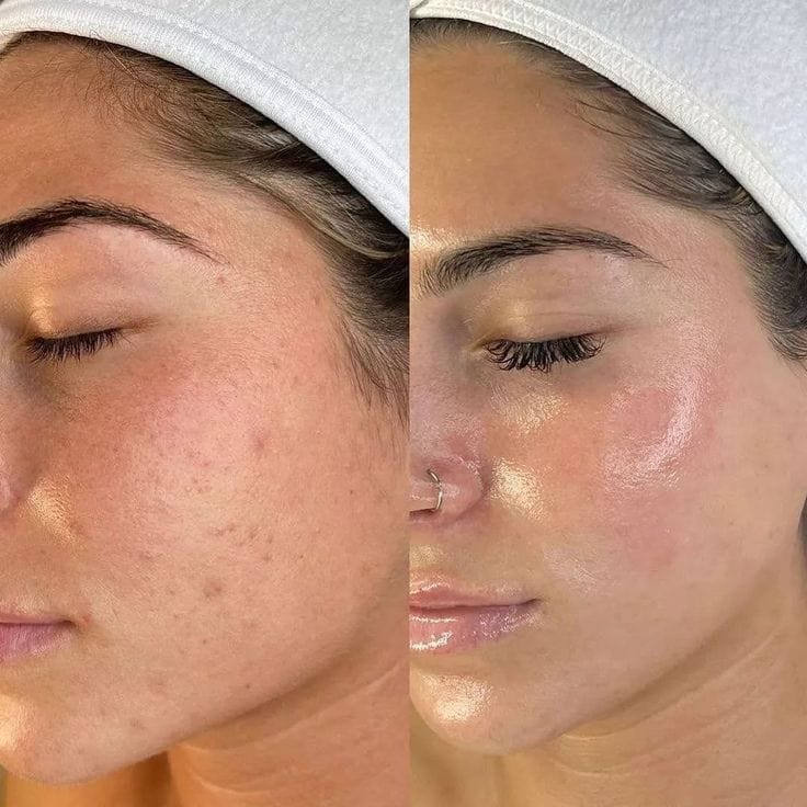 Glow-Up Bio-D Collagen Mask