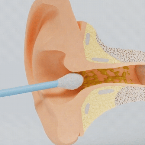 VisiPick Ear Cleaner with Camera
